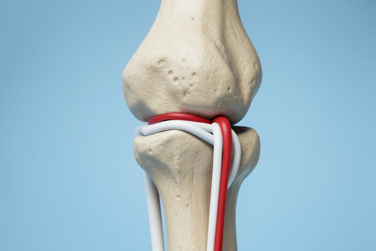 Modelo anatómico de los ligamentos cruzados de la rodilla